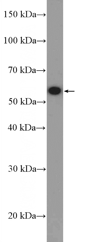 HEK-293 cells were subjected to SDS PAGE followed by western blot with Catalog No:109237(CHMP7 Antibody) at dilution of 1:1000