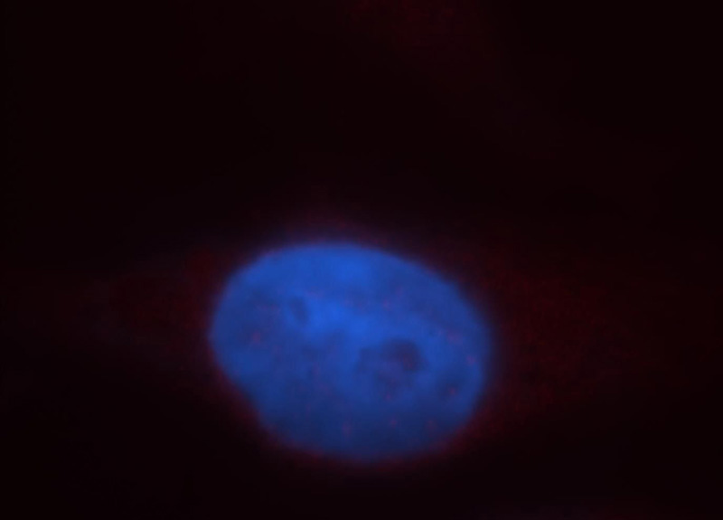 Immunofluorescent analysis of Hela cells, using Gli2 antibody Catalog No:111021 at 1:25 dilution and Rhodamine-labeled goat anti-rabbit IgG (red). Blue pseudocolor = DAPI (fluorescent DNA dye).