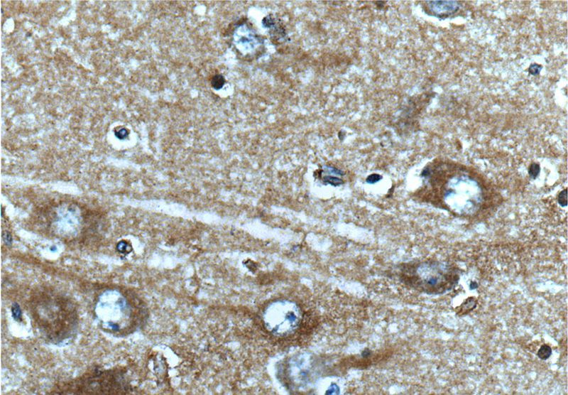 Immunohistochemistry of paraffin-embedded human brain tissue slide using Catalog No:108915(CAMK2A-Specific Antibody) at dilution of 1:50 (under 40x lens)