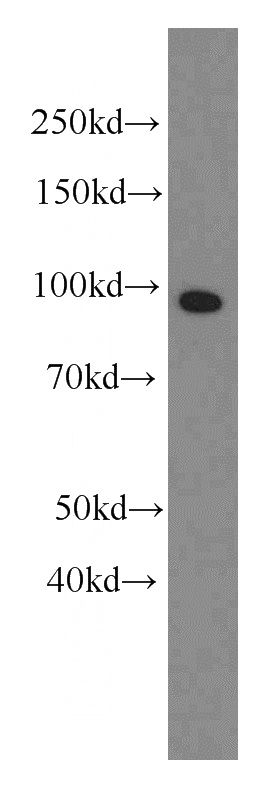 human blood tissue were subjected to SDS PAGE followed by western blot with Catalog No:107169(CFB antibody) at dilution of 1:1000