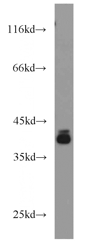 HT-1080 cells were subjected to SDS PAGE followed by western blot with Catalog No:113893(PIGK antibody) at dilution of 1:1000