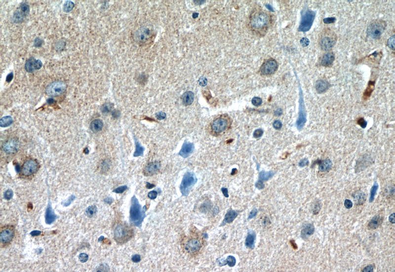 Immunohistochemistry of paraffin-embedded mouse brain tissue slide using Catalog No:109869(SLC6A3 Antibody) at dilution of 1:50 (under 40x lens)