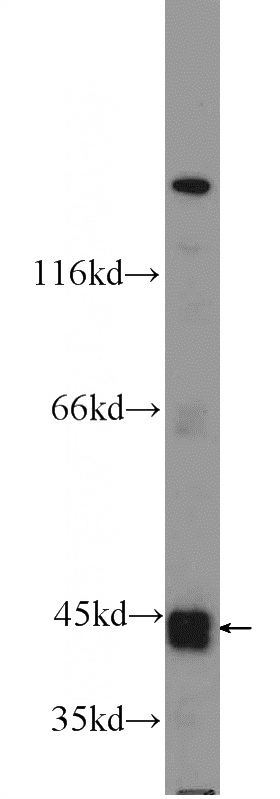 mouse kidney tissue were subjected to SDS PAGE followed by western blot with Catalog No:114740(RNF135 Antibody) at dilution of 1:600