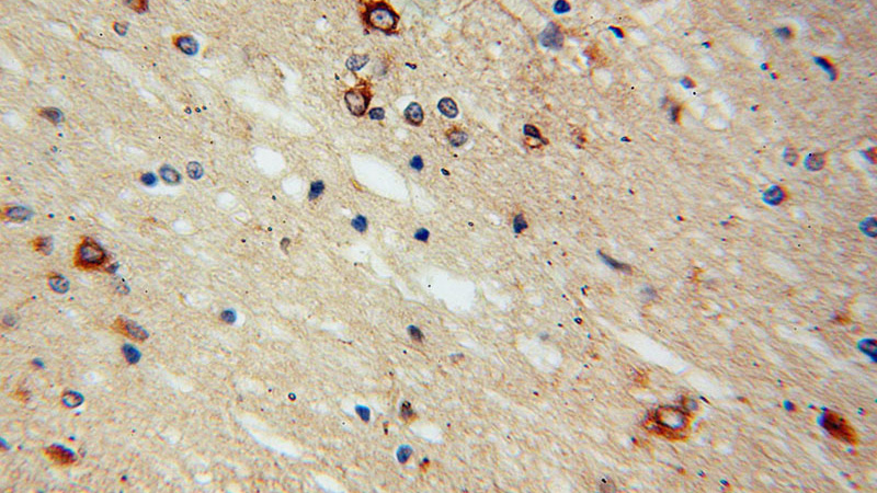 Immunohistochemical of paraffin-embedded human brain using Catalog No:115041(SACM1L antibody) at dilution of 1:100 (under 40x lens)