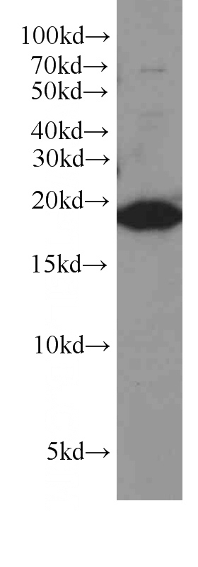 A2780 cells were subjected to SDS PAGE followed by western blot with Catalog No:107628(TMEM70 antibody) at dilution of 1:500