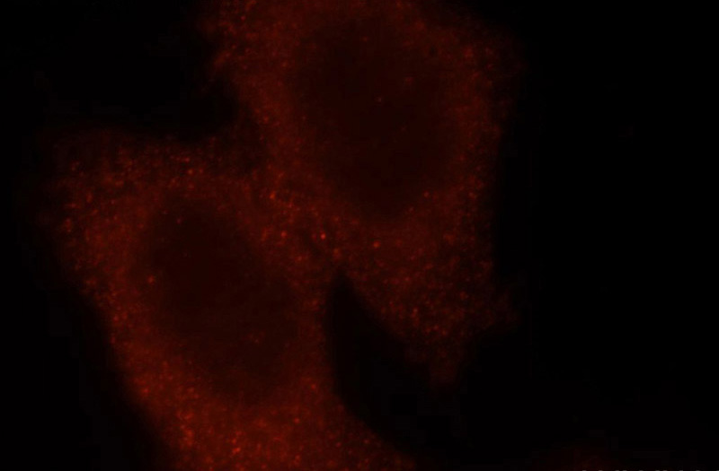 Immunofluorescent analysis of Hela cells, using RSAD2 antibody Catalog No:114933 at 1:25 dilution and Rhodamine-labeled goat anti-rabbit IgG (red).