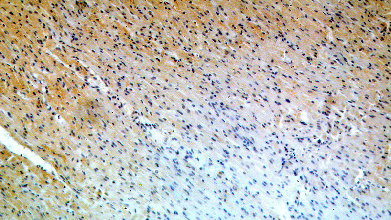 Immunohistochemical of paraffin-embedded human heart using Catalog No:113520(OVCA1 antibody) at dilution of 1:50 (under 10x lens)