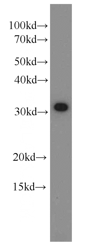 MCF7 cells were subjected to SDS PAGE followed by western blot with Catalog No:109318(CIP29 antibody) at dilution of 1:1500