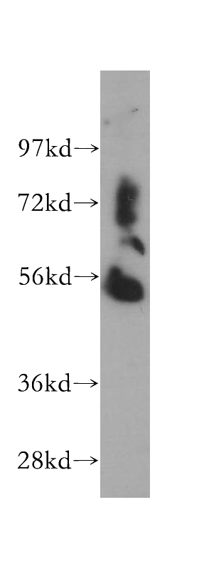 human liver tissue were subjected to SDS PAGE followed by western blot with Catalog No:116841(WARS2 antibody) at dilution of 1:500