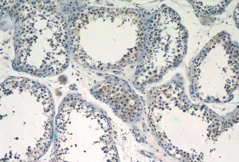 Immunohistochemistry of paraffin-embedded human testis tissue slide using Catalog No:108907(CALR3 Antibody) at dilution of 1:50 (under 10x lens)