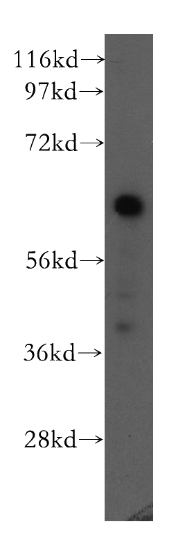 K-562 cells were subjected to SDS PAGE followed by western blot with Catalog No:107603(IL1RL1 antibody) at dilution of 1:300