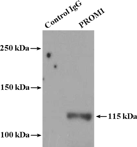IP Result of anti-CD133-1,2,3,5,7 (IP:Catalog No:109050, 4ug; Detection:Catalog No:109050 1:300) with Y79 cells lysate 2000ug.