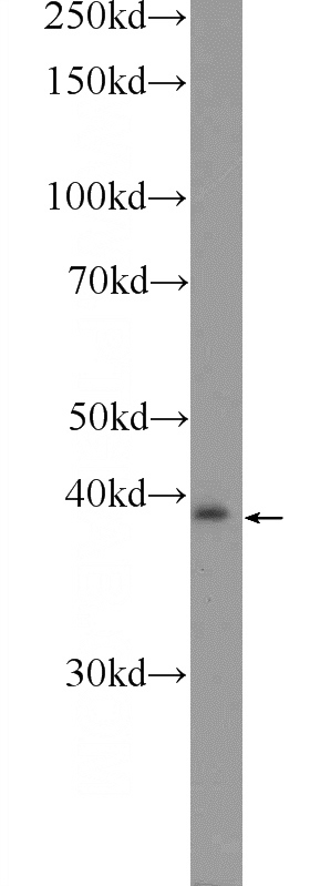 mouse liver tissue were subjected to SDS PAGE followed by western blot with Catalog No:114350(PXMP3 Antibody) at dilution of 1:600