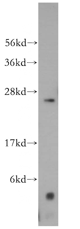 HeLa cells were subjected to SDS PAGE followed by western blot with Catalog No:112857(MRPS34 antibody) at dilution of 1:500