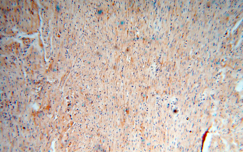 Immunohistochemical of paraffin-embedded human heart using Catalog No:109104(CDC37L1 antibody) at dilution of 1:50 (under 10x lens)