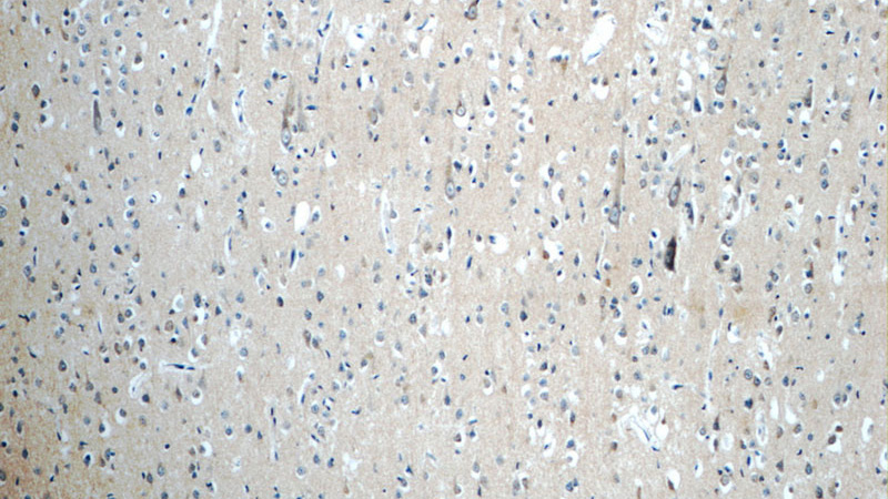 Immunohistochemistry of paraffin-embedded human brain tissue slide using Catalog No:108020(APLP1 Antibody) at dilution of 1:50 (under 10x lens)