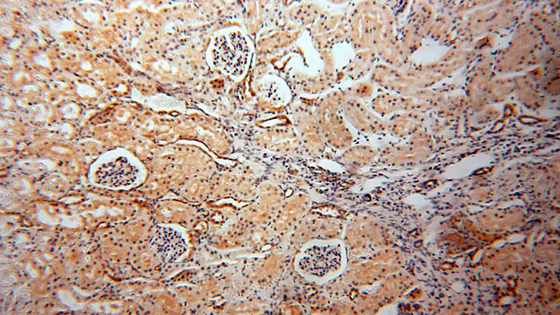 Immunohistochemical of paraffin-embedded human kidney using Catalog No:116335(Transgelin-2-specific antibody) at dilution of 1:50 (under 10x lens)