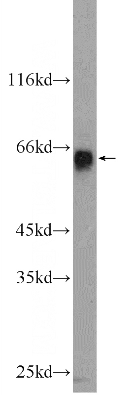 COLO 320 cells were subjected to SDS PAGE followed by western blot with Catalog No:117057(ZIM3 Antibody) at dilution of 1:300