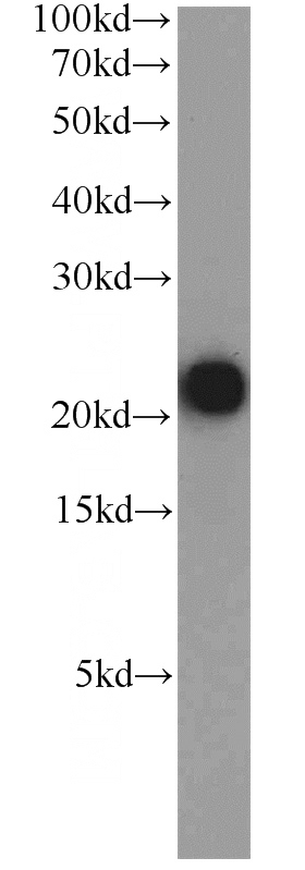 human placenta tissue were subjected to SDS PAGE followed by western blot with Catalog No:116093(TMEM11 antibody) at dilution of 1:1000