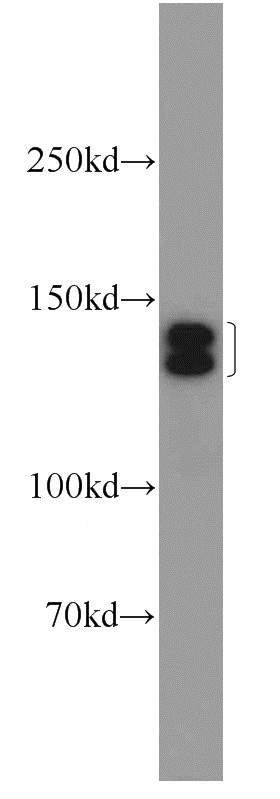 mouse skeletal muscle tissue were subjected to SDS PAGE followed by western blot with Catalog No:113818(PHKA1 Antibody) at dilution of 1:600