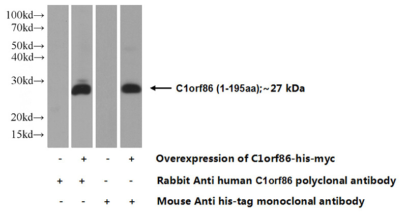 Transfected HEK-293 cells were subjected to SDS PAGE followed by western blot with Catalog No:108683(C1orf86 Antibody) at dilution of 1:500
