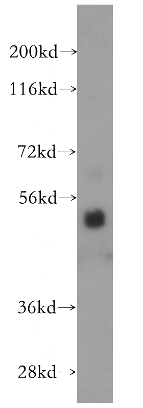 HL-60 cells were subjected to SDS PAGE followed by western blot with Catalog No:114781(ROD1 antibody) at dilution of 1:500