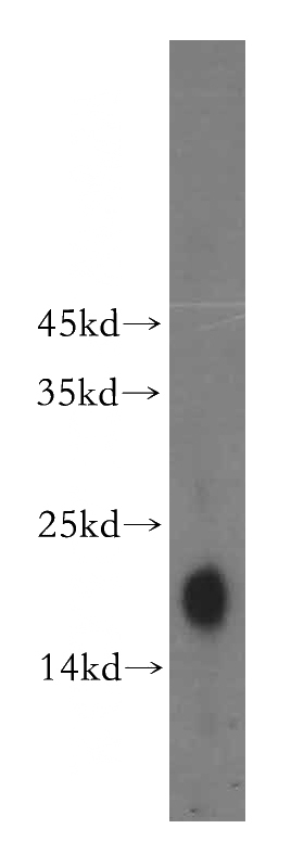mouse skin tissue were subjected to SDS PAGE followed by western blot with Catalog No:113078(NDUFB9 antibody) at dilution of 1:500