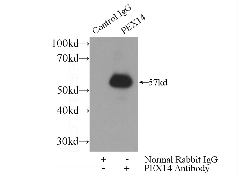 IP Result of anti-PEX14 (IP:Catalog No:113727, 3ug; Detection:Catalog No:113727 1:500) with mouse liver tissue lysate 4000ug.