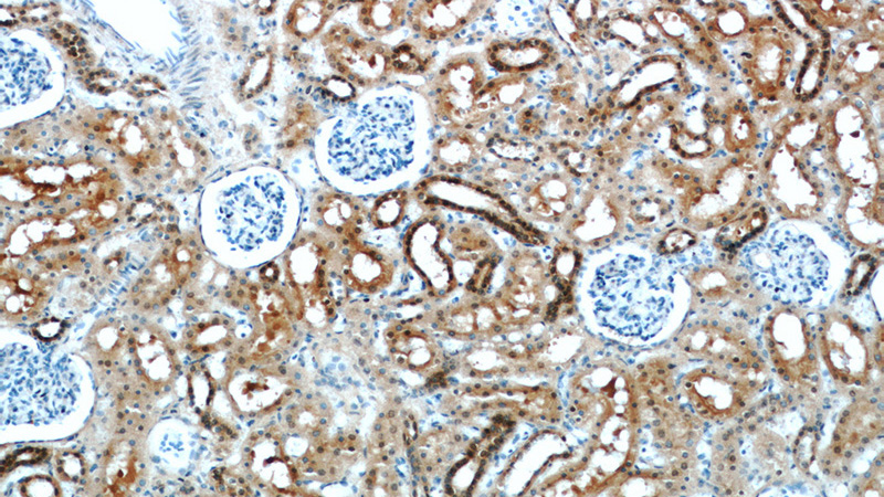 Immunohistochemical of paraffin-embedded human kidney using Catalog No:111385(HDDC3 antibody) at dilution of 1:100 (under 10x lens)