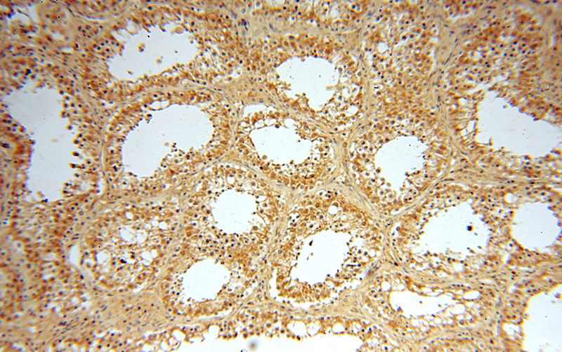 Immunohistochemical of paraffin-embedded human testis using Catalog No:116719(VASP antibody) at dilution of 1:100 (under 10x lens)