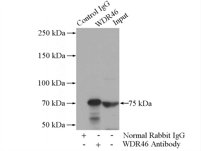 IP Result of anti-WDR46 (IP:Catalog No:116869, 4ug; Detection:Catalog No:116869 1:400) with Jurkat cells lysate 3200ug.