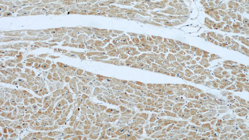 Immunohistochemical of paraffin-embedded human heart using Catalog No:107215(FBLN5 antibody) at dilution of 1:50 (under 10x lens)