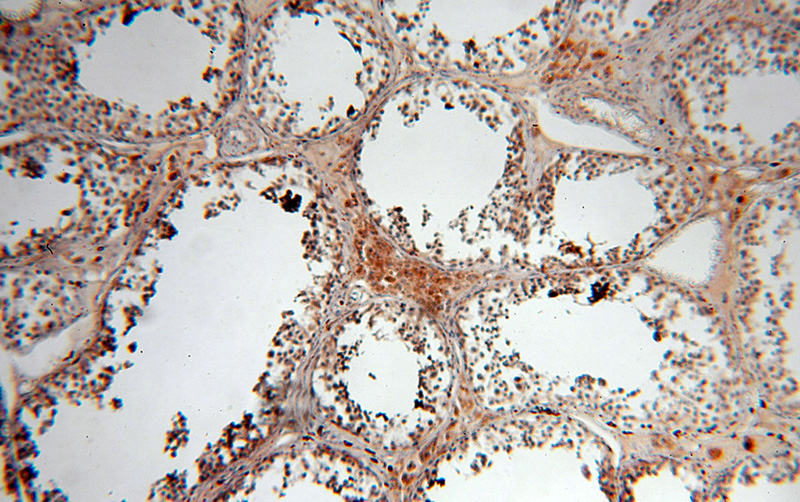 Immunohistochemical of paraffin-embedded human testis using Catalog No:115936(TEKT1 antibody) at dilution of 1:100 (under 10x lens)