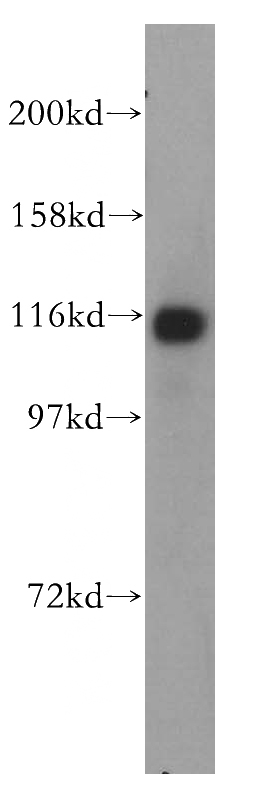 HepG2 cells were subjected to SDS PAGE followed by western blot with Catalog No:114121(PPFIBP1 antibody) at dilution of 1:1000