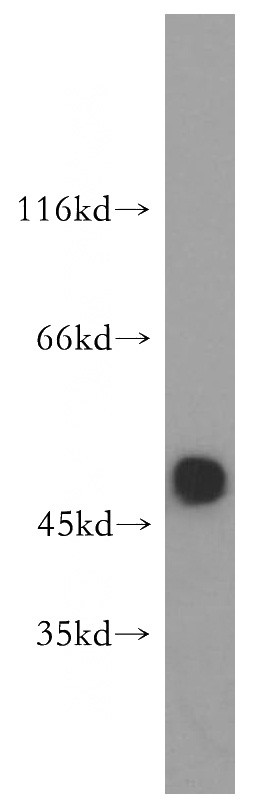 mouse brain tissue were subjected to SDS PAGE followed by western blot with Catalog No:111030(GLRA1 antibody) at dilution of 1:500