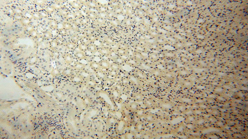 Immunohistochemical of paraffin-embedded human kidney using Catalog No:113835(PISD antibody) at dilution of 1:100 (under 10x lens)