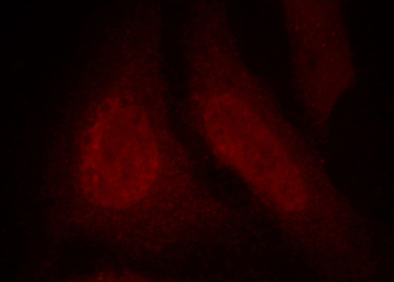 Immunofluorescent analysis of Hela cells, using DDB1 antibody Catalog No: at 1:25 dilution and Rhodamine-labeled goat anti-mouse IgG (red).
