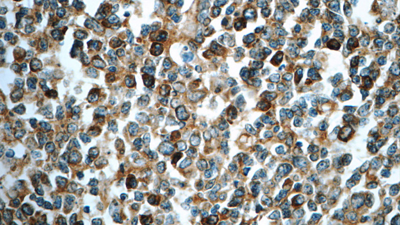 Immunohistochemistry of paraffin-embedded human tonsillitis tissue slide using Catalog No:112320(LRMP Antibody) at dilution of 1:50 (under 40x lens)