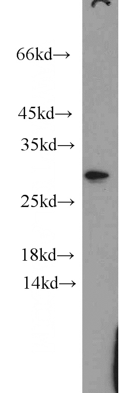 HeLa cells were subjected to SDS PAGE followed by western blot with Catalog No:109339(CLDN22 antibody) at dilution of 1:500