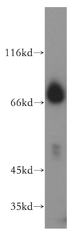 MCF7 cells were subjected to SDS PAGE followed by western blot with Catalog No:109722(CTDSPL2 antibody) at dilution of 1:500