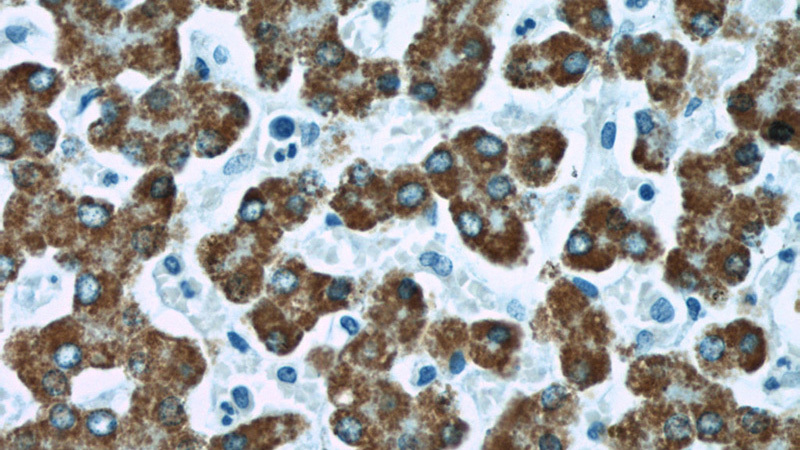 Immunohistochemical of paraffin-embedded human liver using Catalog No:107971(ALDH4A1 antibody) at dilution of 1:100 (under 40x lens)