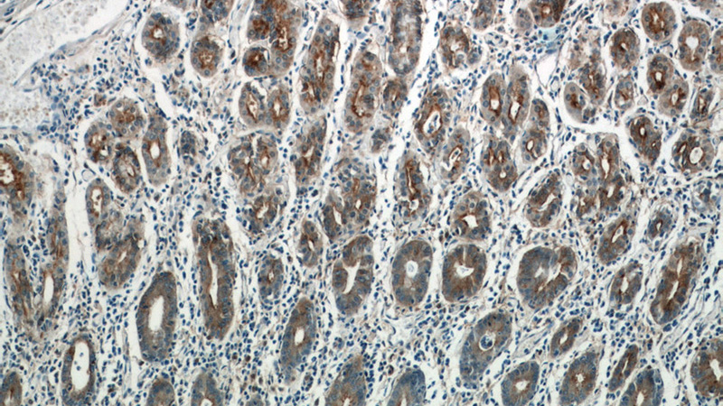 Immunohistochemistry of paraffin-embedded human stomach tissue slide using Catalog No:108095(Annexin IV Antibody) at dilution of 1:50 (under 10x lens)