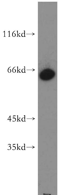 HepG2 cells were subjected to SDS PAGE followed by western blot with Catalog No:116956(ZNF192 antibody) at dilution of 1:500