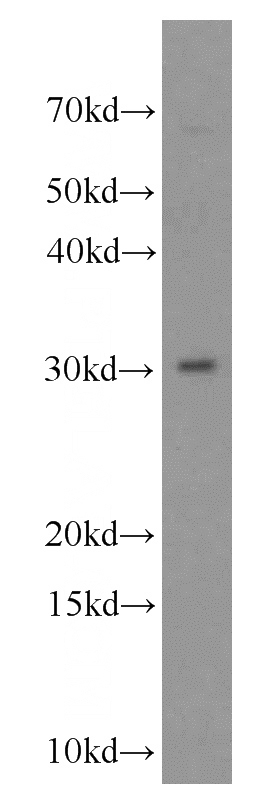 mouse testis tissue were subjected to SDS PAGE followed by western blot with Catalog No:116733(VDAC3 antibody) at dilution of 1:300