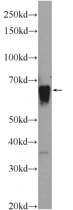 human plasma tissue were subjected to SDS PAGE followed by western blot with Catalog No:115207(SERPIND1 Antibody) at dilution of 1:600