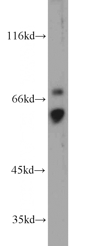 HL-60 cells were subjected to SDS PAGE followed by western blot with Catalog No:109144(FCAR antibody) at dilution of 1:300