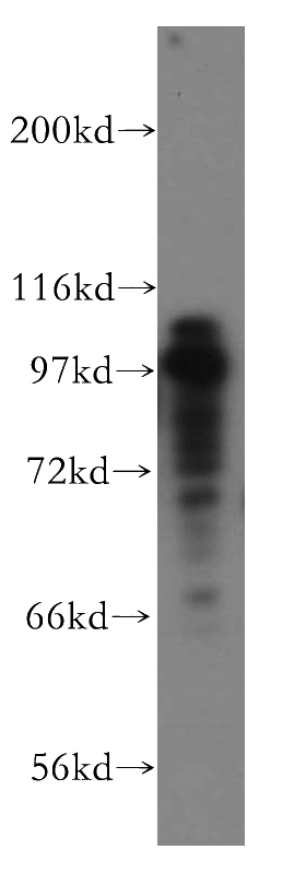 HeLa cells were subjected to SDS PAGE followed by western blot with Catalog No:112553(MCM3 antibody) at dilution of 1:500
