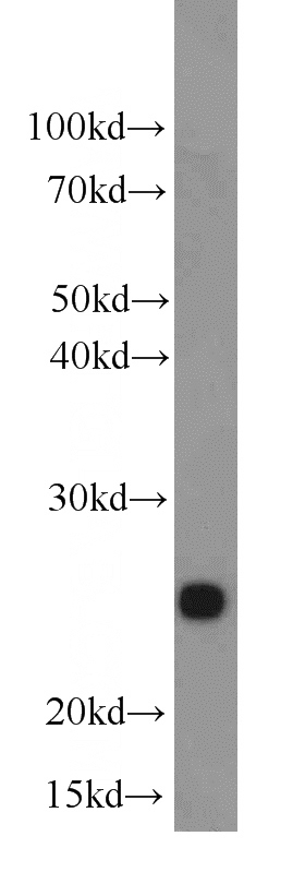 mouse kidney tissue were subjected to SDS PAGE followed by western blot with Catalog No:115228(SIGMAR1 antibody) at dilution of 1:500