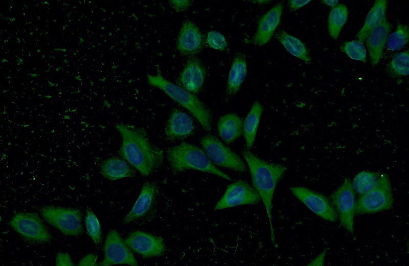 Immunofluorescent analysis of HeLa cells using Catalog No:107489(PSMD4 Antibody) at dilution of 1:50 and Alexa Fluor 488-congugated AffiniPure Goat Anti-Mouse IgG(H+L)