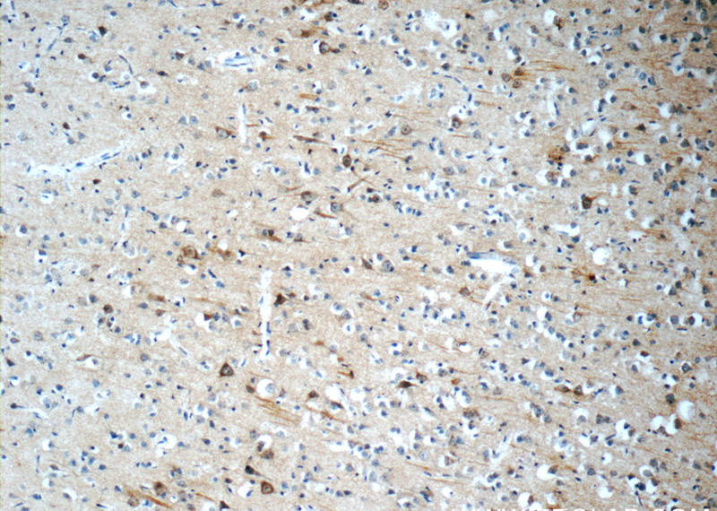 Immunohistochemistry of paraffin-embedded human brain slide using Catalog No:108360(Barkor Antibody) at dilution of 1:50 (under 10x lens)